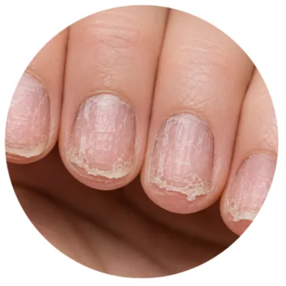 Home Dry, brittle-looking fingernails with rough nail surfaces